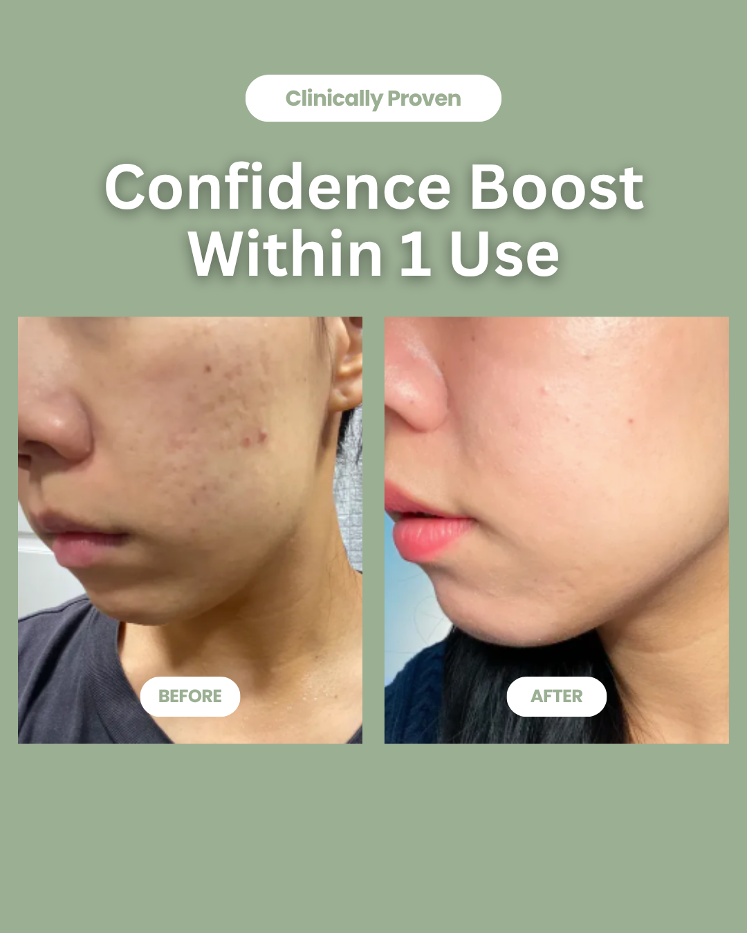 Soyeon TM - Green Tomato Clay Mask & Cleanser