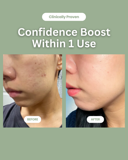 Soyeon TM - Green Tomato Clay Mask & Cleanser