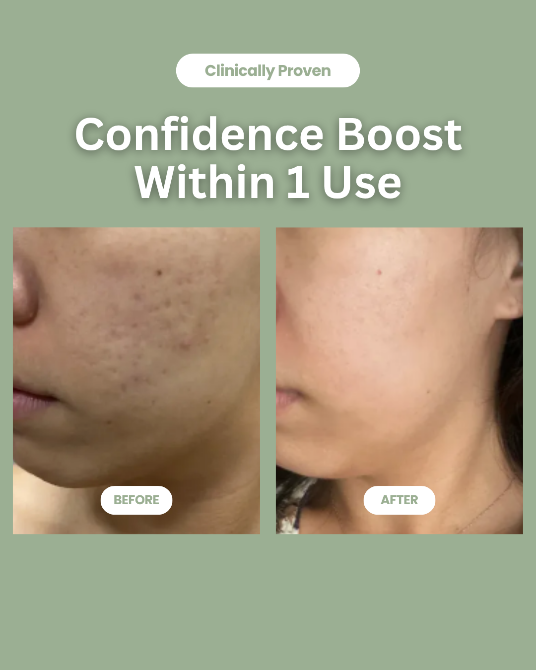 Soyeon TM - Green Tomato Clay Mask & Cleanser